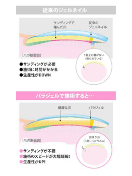 パラジェルとは。